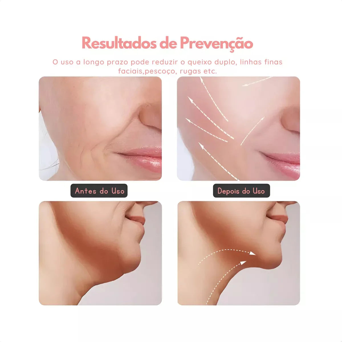 MASSAGEM FACIAL -  Led Aparelho Tratamento Com Luz (Cor Sortida) Generico